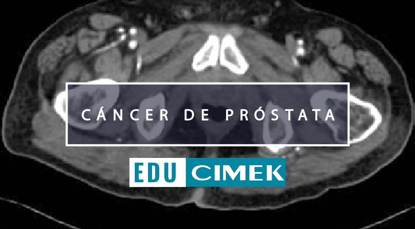controles médico cancer prostata
