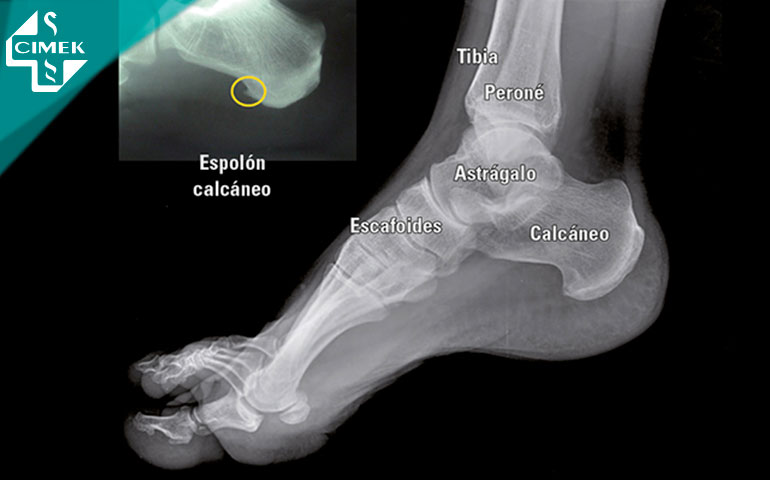 examen funcional del pie