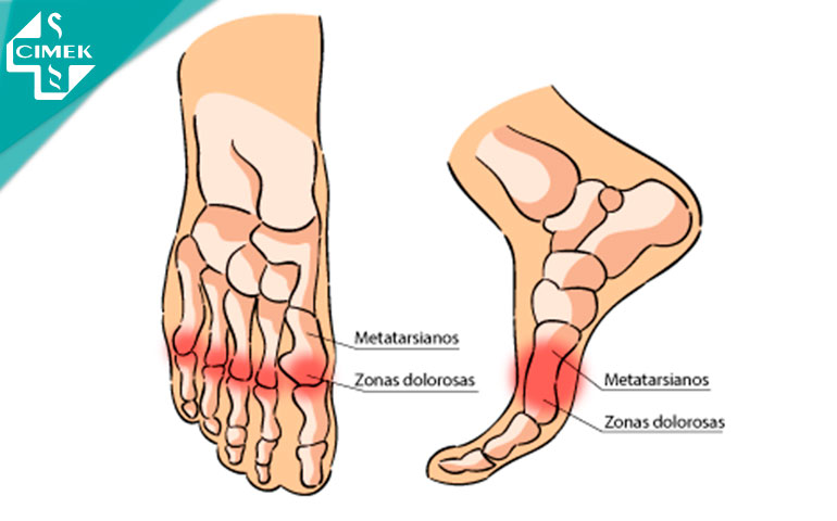 examen funcional del pie