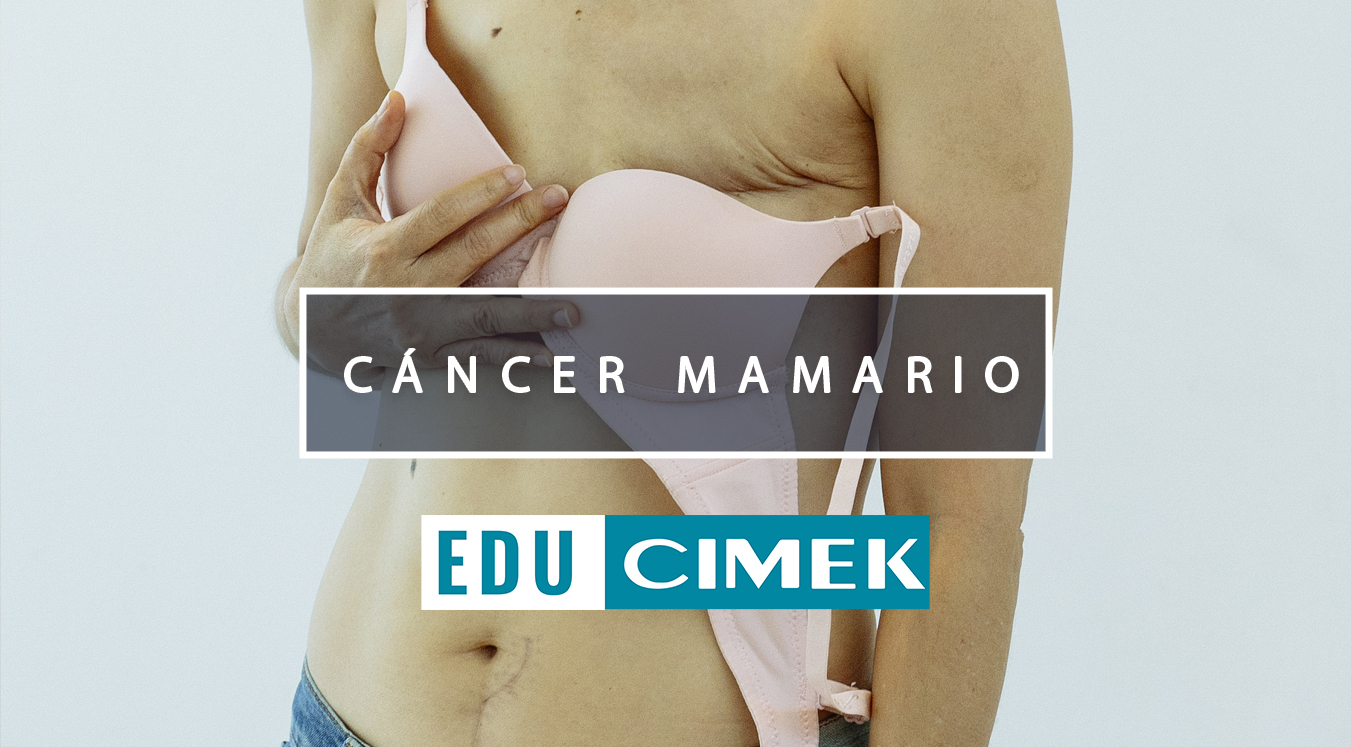 mamografía CIMEK rancagua