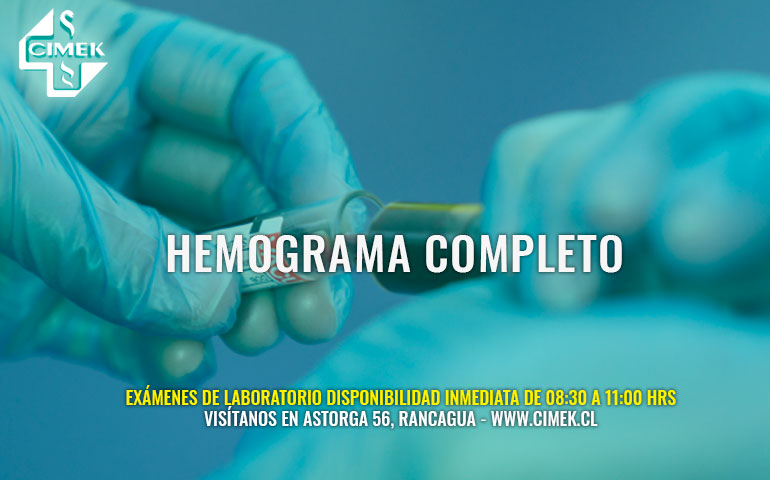 Test de helicobacter pylori CIMEK Rancagua